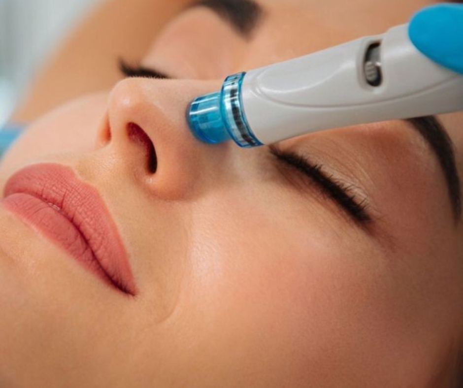 LPG therapy for radiant skin